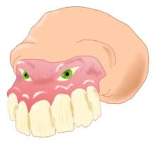 Cartoon - Dental 